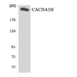 Western Blot - Anti-CACNA1H Antibody (R12-2560) - Antibodies.com