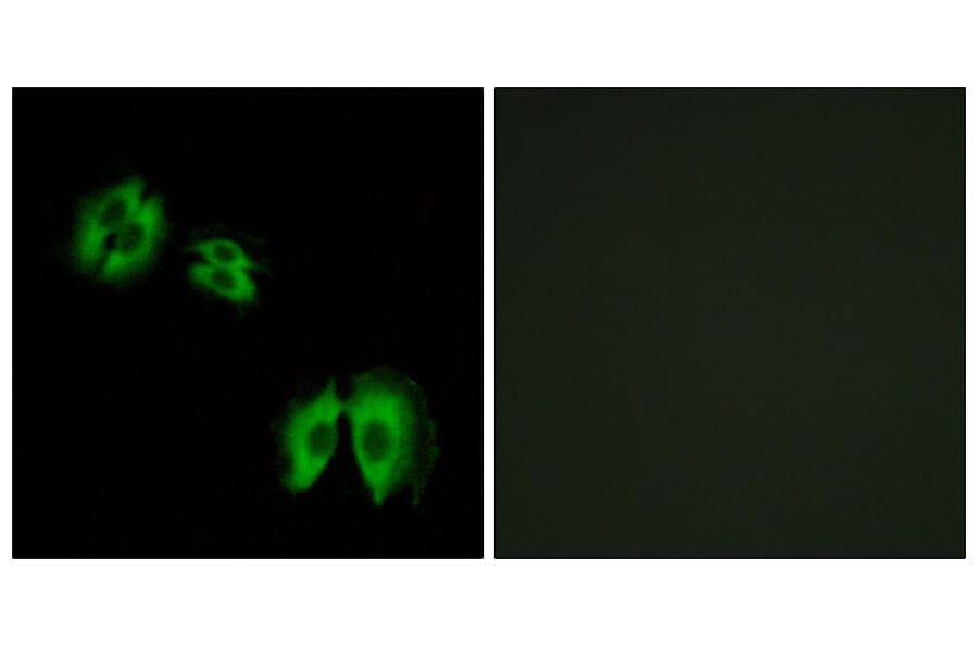 Immunofluorescence - Anti-B3GALT2 Antibody (C14713) - Antibodies.com