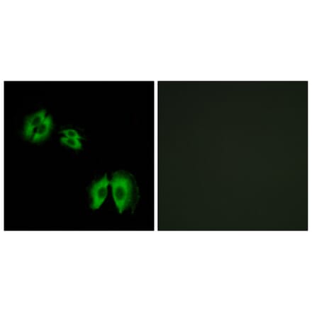 Immunofluorescence - Anti-B3GALT2 Antibody (C14713) - Antibodies.com