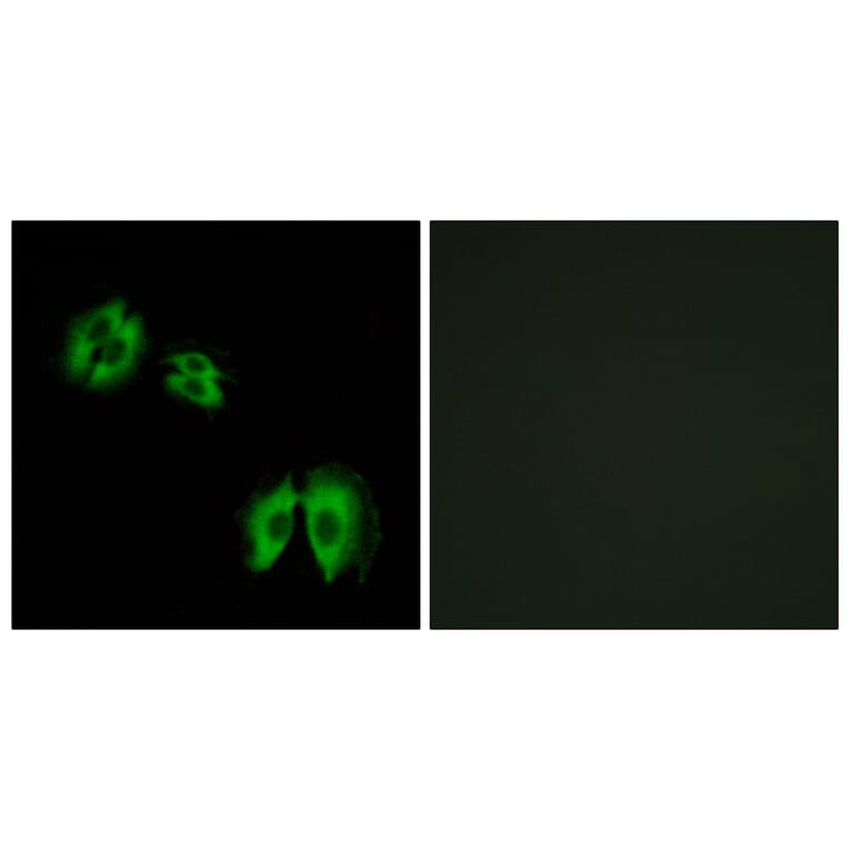 Immunofluorescence - Anti-B3GALT2 Antibody (C14713) - Antibodies.com