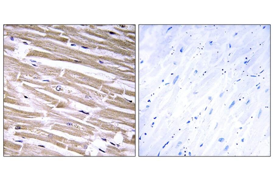 Immunohistochemistry - Anti-B3GALT2 Antibody (C14713) - Antibodies.com