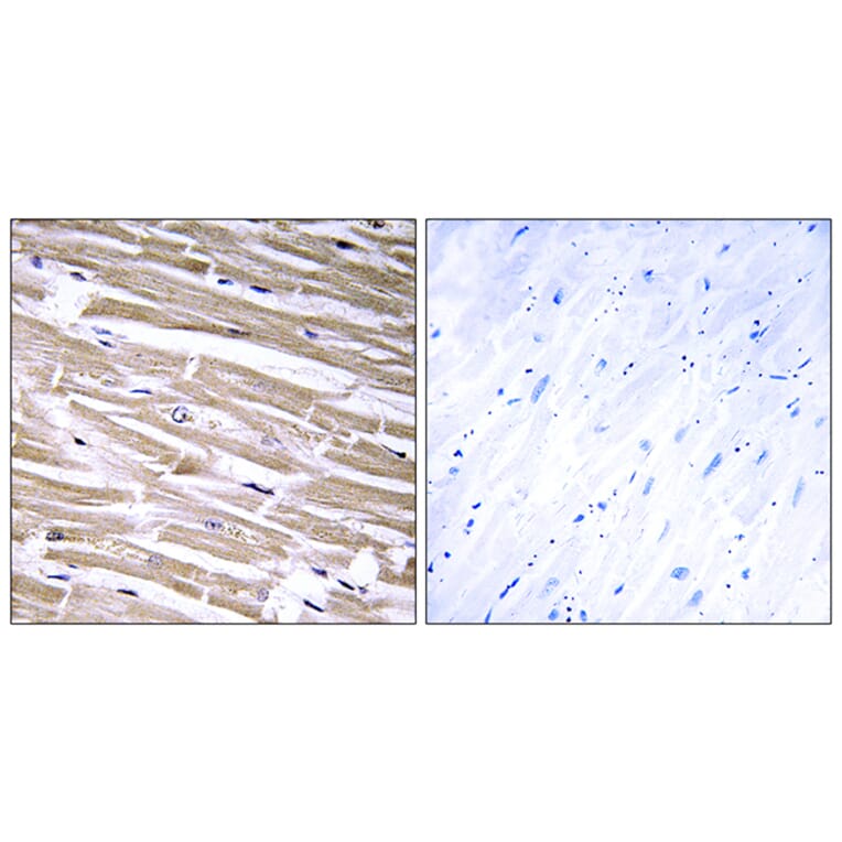 Immunohistochemistry - Anti-B3GALT2 Antibody (C14713) - Antibodies.com