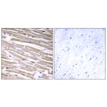 Immunohistochemistry - Anti-B3GALT2 Antibody (C14713) - Antibodies.com