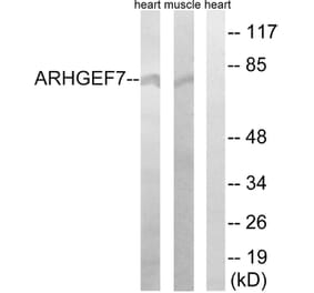 Western Blot - Anti-ARHGEF7 Antibody (C18397) - Antibodies.com