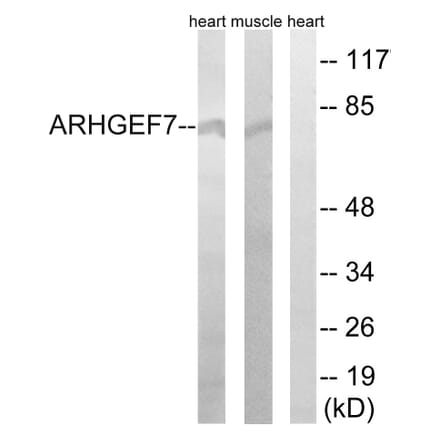 Western Blot - Anti-ARHGEF7 Antibody (C18397) - Antibodies.com