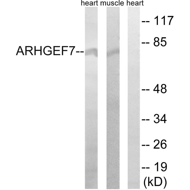 Western Blot - Anti-ARHGEF7 Antibody (C18397) - Antibodies.com