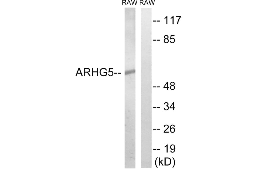 Western Blot - Anti-ARHGEF5 Antibody (C18395) - Antibodies.com