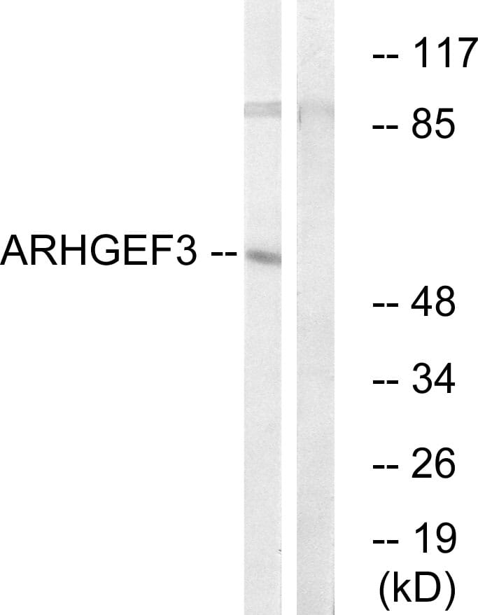 Western blot analysis of lysates from COLO cells using Anti-ARHGEF3 Antibody. The right hand lane represents a negative control, where the antibody is blocked by the immunising peptide.