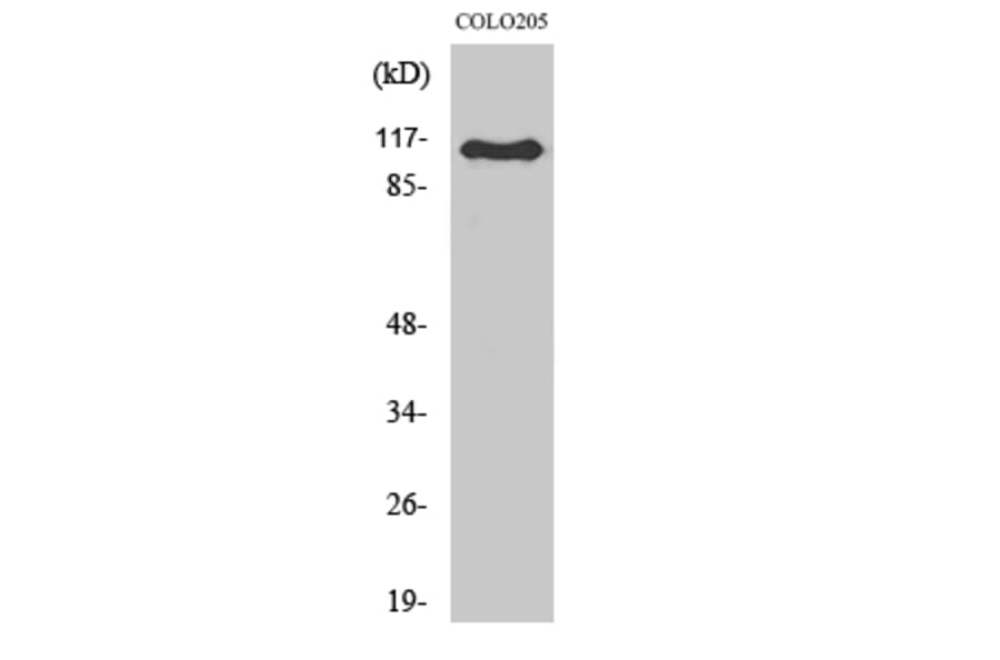 Western Blot - Anti-ARHGEF1 Antibody (C18385) - Antibodies.com