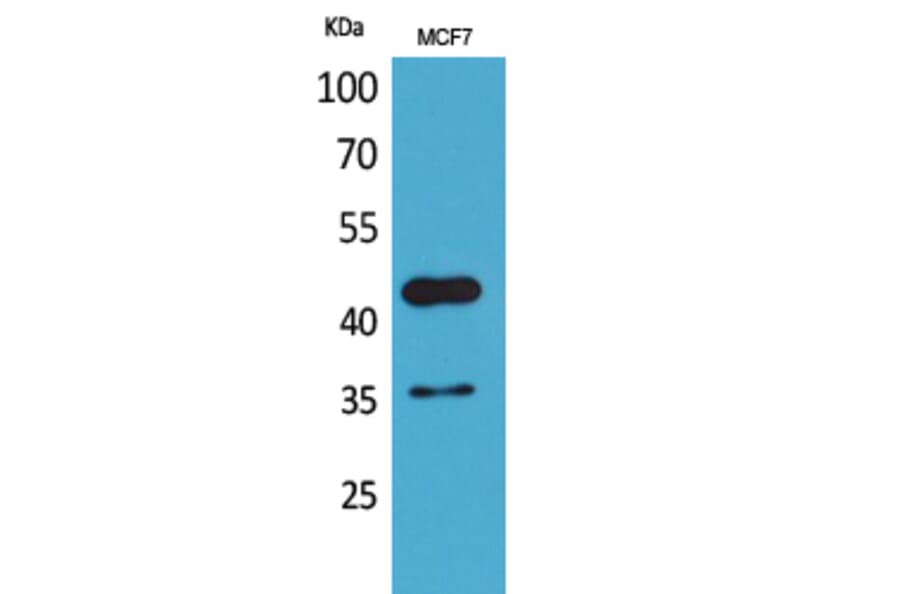 Western Blot - Anti-ANGPTL4 Antibody (C30090) - Antibodies.com