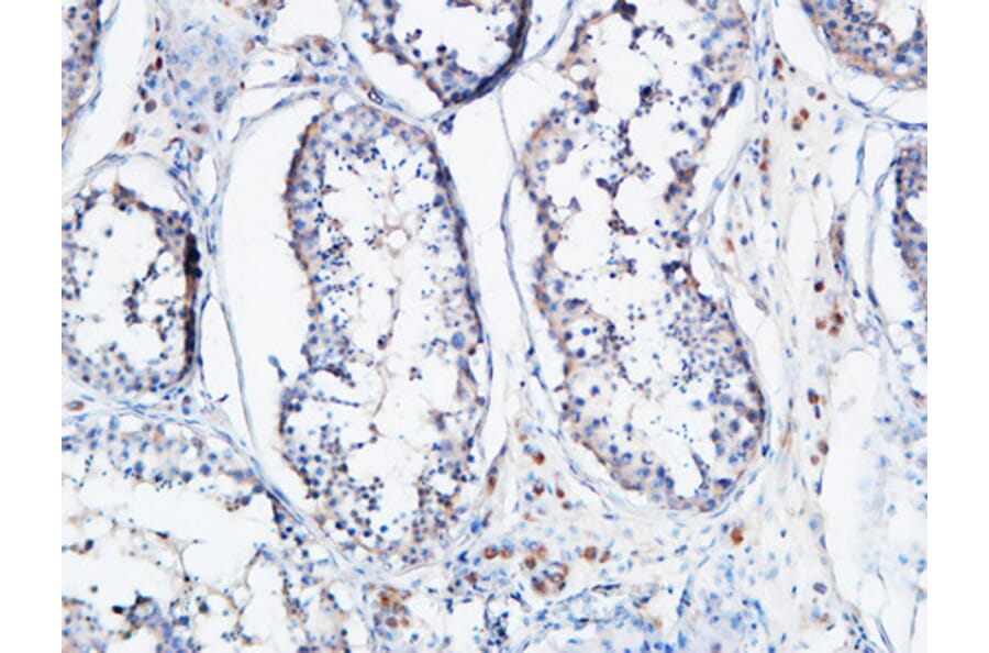Immunohistochemistry - Anti-ANGPTL4 Antibody (C30090) - Antibodies.com