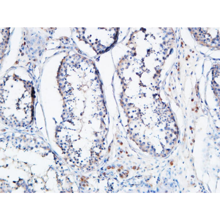 Immunohistochemistry - Anti-ANGPTL4 Antibody (C30090) - Antibodies.com