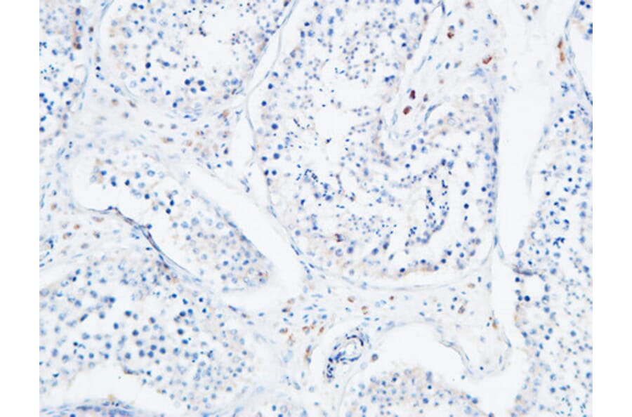 Immunohistochemistry - Anti-ANGPTL4 Antibody (C30090) - Antibodies.com
