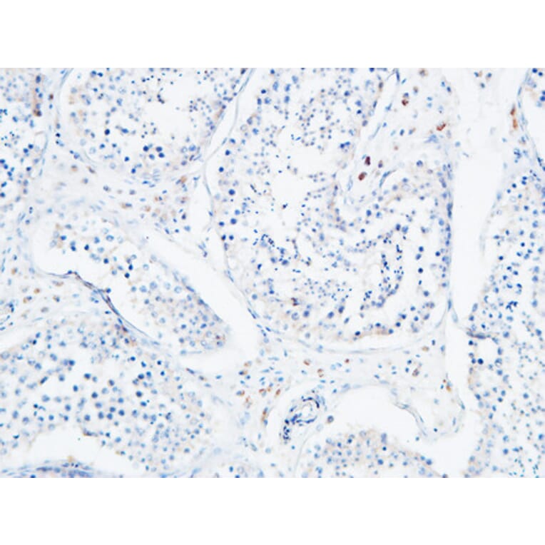 Immunohistochemistry - Anti-ANGPTL4 Antibody (C30090) - Antibodies.com