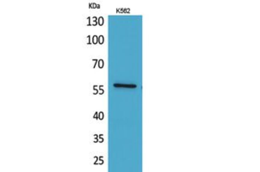 Western Blot - Anti-ANGPTL1 Antibody (C30068) - Antibodies.com
