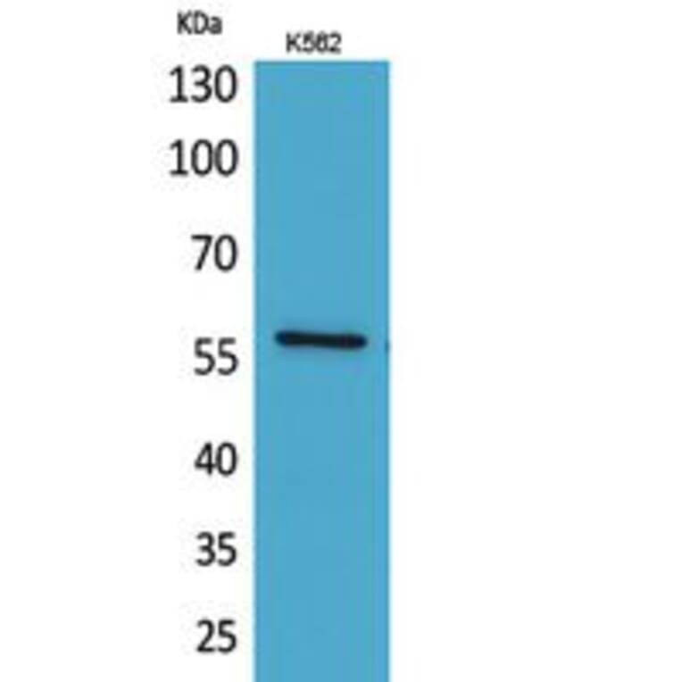 Western Blot - Anti-ANGPTL1 Antibody (C30068) - Antibodies.com