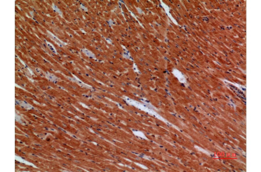 Immunohistochemistry - Anti-ANGPTL1 Antibody (C30068) - Antibodies.com