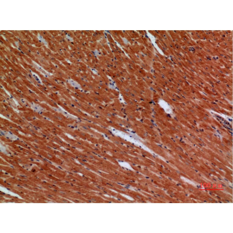 Immunohistochemistry - Anti-ANGPTL1 Antibody (C30068) - Antibodies.com