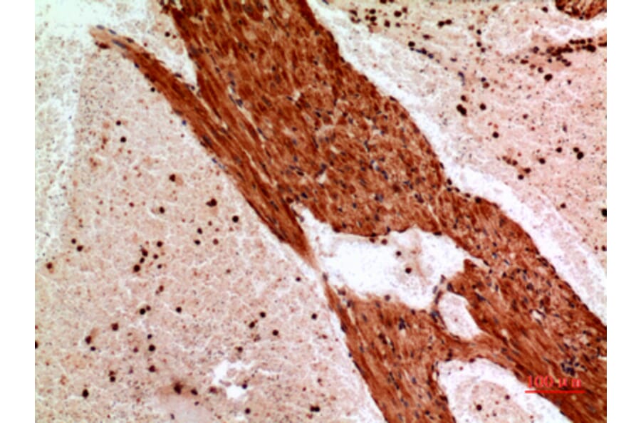 Immunohistochemistry - Anti-ANGPTL1 Antibody (C30068) - Antibodies.com
