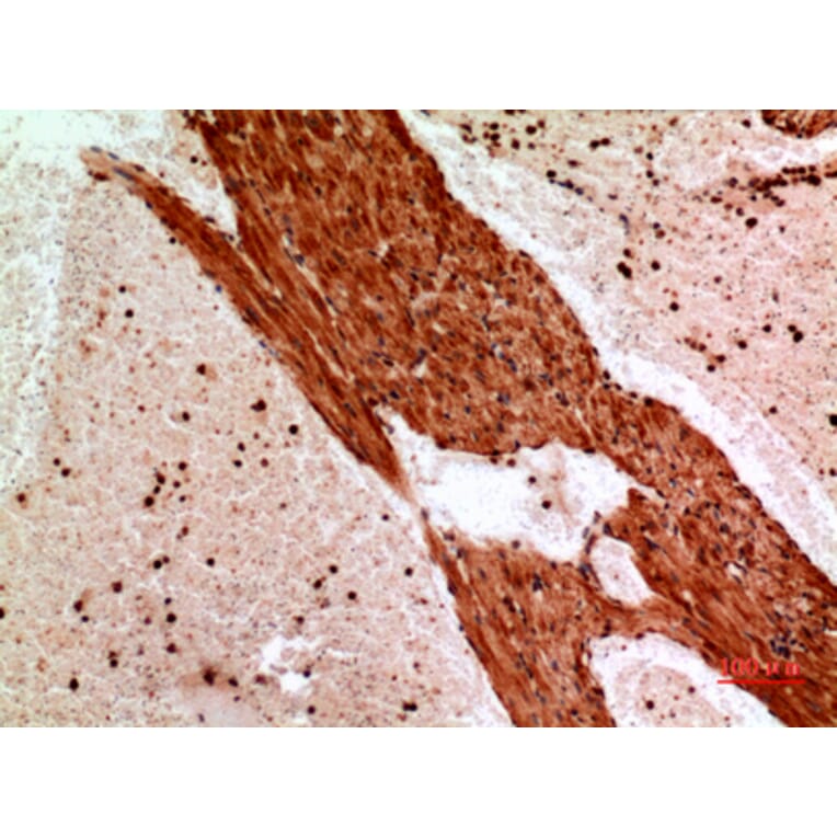 Immunohistochemistry - Anti-ANGPTL1 Antibody (C30068) - Antibodies.com