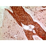 Immunohistochemistry - Anti-ANGPTL1 Antibody (C30068) - Antibodies.com