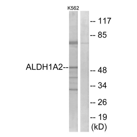 Western Blot - Anti-ALDH1A2 Antibody (C18344) - Antibodies.com