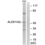 Western Blot - Anti-ALDH1A2 Antibody (C18344) - Antibodies.com