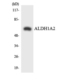 Western Blot - Anti-ALDH1A2 Antibody (R12-2473) - Antibodies.com