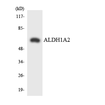 Western Blot - Anti-ALDH1A2 Antibody (R12-2473) - Antibodies.com