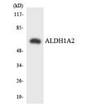 Western Blot - Anti-ALDH1A2 Antibody (R12-2473) - Antibodies.com
