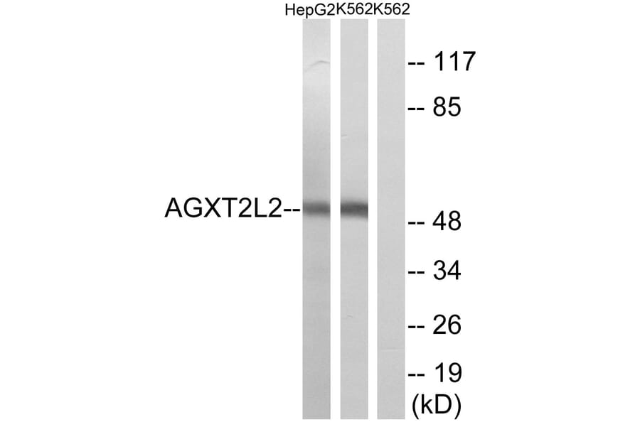Western Blot - Anti-AGXT2L2 Antibody (C14373) - Antibodies.com