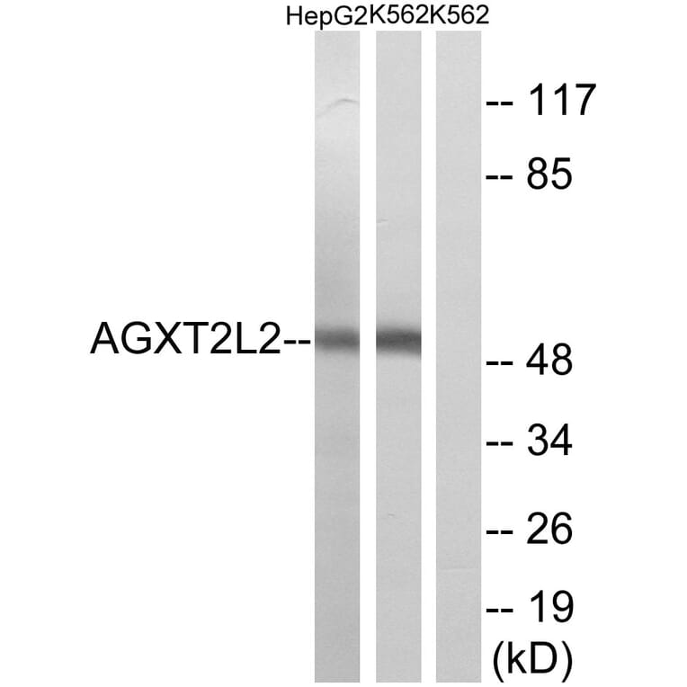 Western Blot - Anti-AGXT2L2 Antibody (C14373) - Antibodies.com