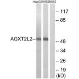 Western Blot - Anti-AGXT2L2 Antibody (C14373) - Antibodies.com