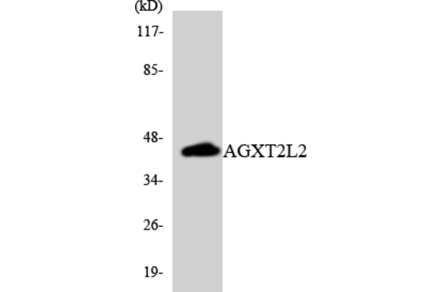 Western Blot - Anti-AGXT2L2 Antibody (R12-2465) - Antibodies.com