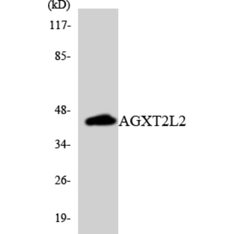 Western Blot - Anti-AGXT2L2 Antibody (R12-2465) - Antibodies.com