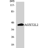 Western Blot - Anti-AGXT2L2 Antibody (R12-2465) - Antibodies.com