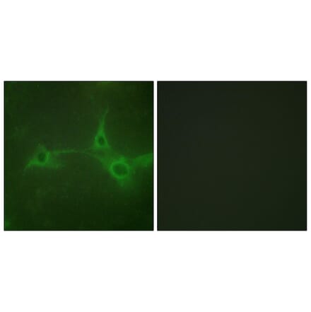 Immunofluorescence - Anti-ADAM 17 Antibody (B0763) - Antibodies.com