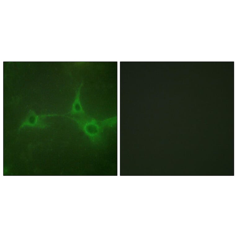 Immunofluorescence - Anti-ADAM 17 Antibody (B0763) - Antibodies.com