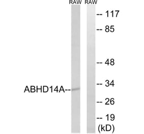 Western Blot - Anti-ABHD14A Antibody (C14212) - Antibodies.com