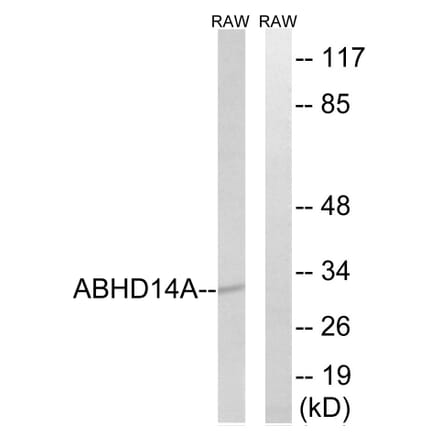 Western Blot - Anti-ABHD14A Antibody (C14212) - Antibodies.com
