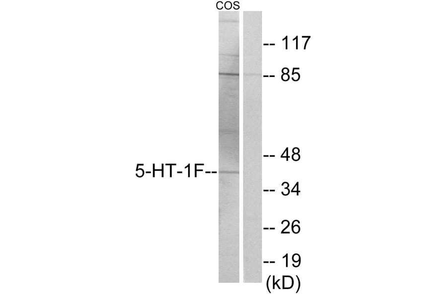 Western Blot - Anti-5-HT-1F Antibody (C12012) - Antibodies.com