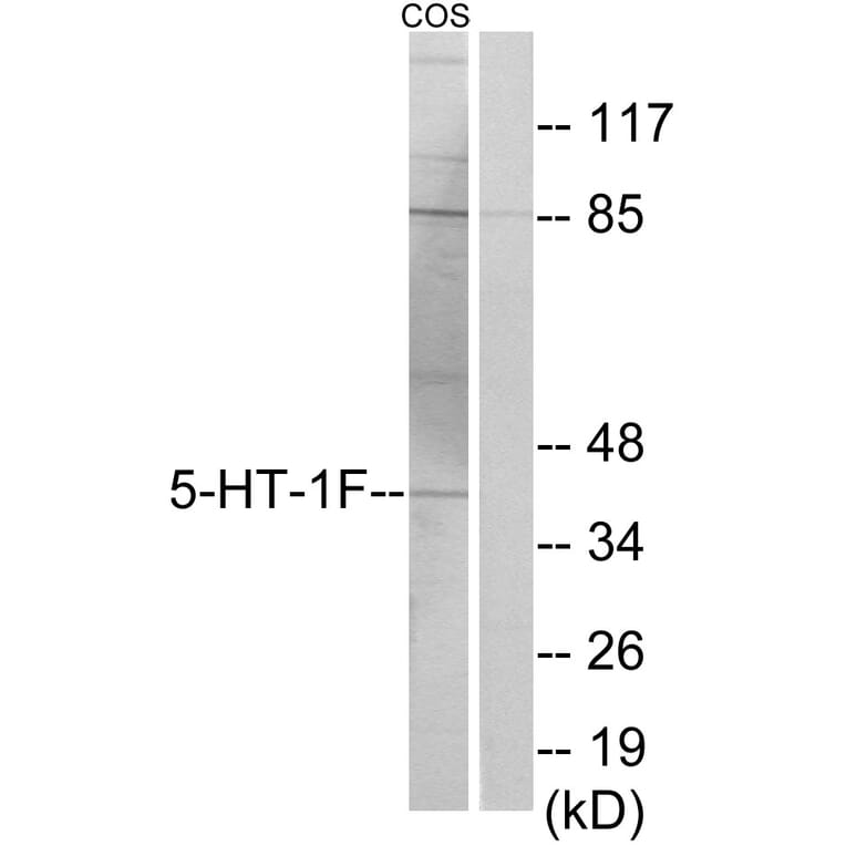 Western Blot - Anti-5-HT-1F Antibody (C12012) - Antibodies.com
