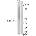 Western Blot - Anti-5-HT-1F Antibody (C12012) - Antibodies.com