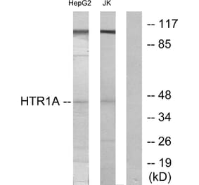 Western Blot - Anti-5-HT-1A Antibody (C12008) - Antibodies.com
