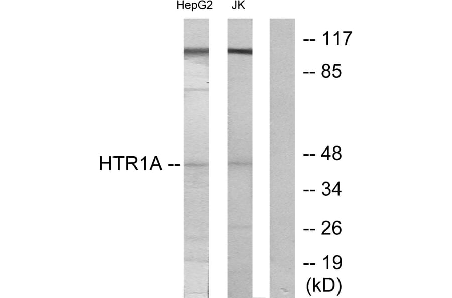 Western Blot - Anti-5-HT-1A Antibody (C12008) - Antibodies.com