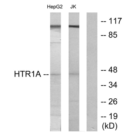 Western Blot - Anti-5-HT-1A Antibody (C12008) - Antibodies.com