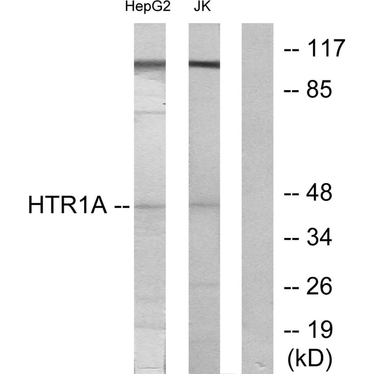 Western Blot - Anti-5-HT-1A Antibody (C12008) - Antibodies.com