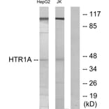 Western Blot - Anti-5-HT-1A Antibody (C12008) - Antibodies.com