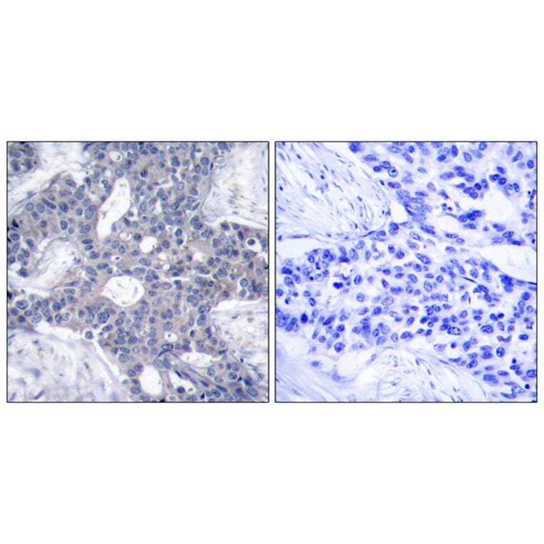 Immunohistochemistry - Anti-ZAP-70 Antibody (B7256) - Antibodies.com