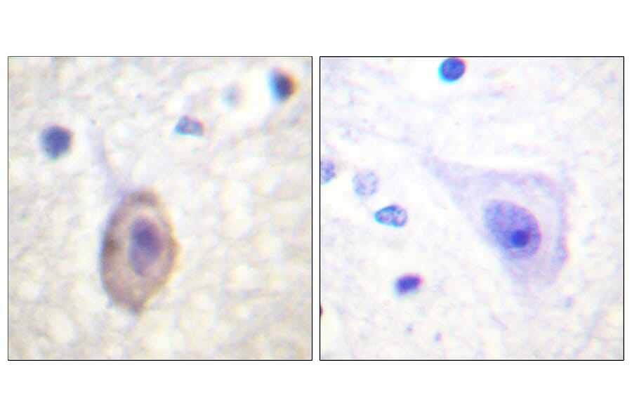 Immunohistochemistry - Anti-VEGFR1 Antibody (B0594) - Antibodies.com